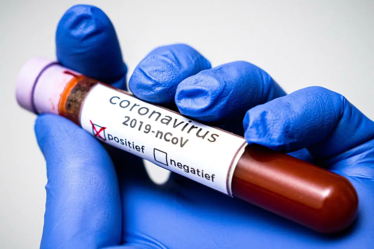 covid-19-koronavirus.jpg
