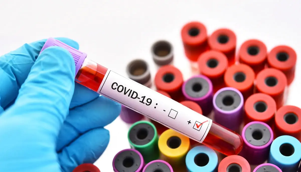 covid-19.jpg