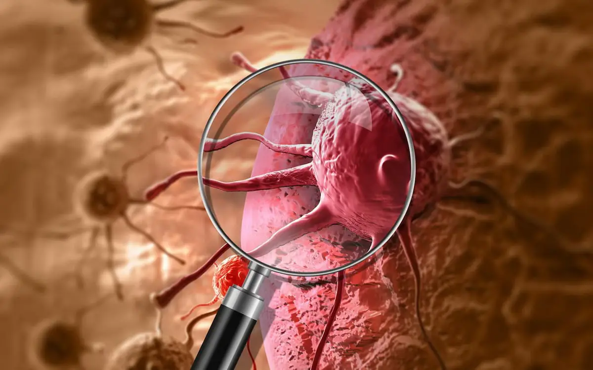 prichina-neizlechimosti-raka.jpg