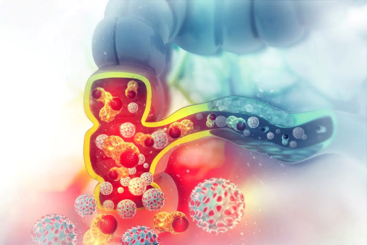 lechenie-raka-kishechnika-immunoterapiej.jpg